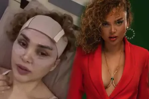 Tiktoker Aydan estetik etdirdi