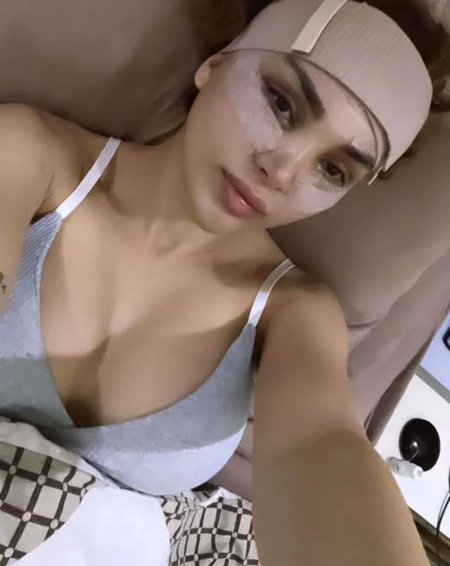 Tiktoker Aydan estetik etdirdi