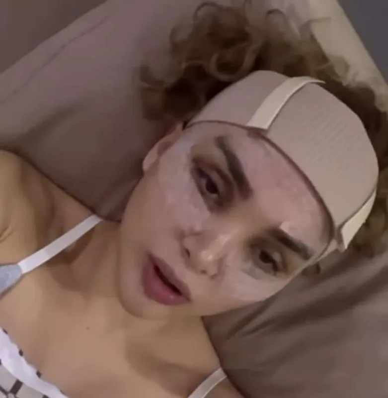 Tiktoker Aydan estetik etdirdi