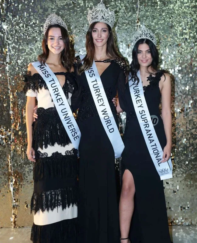 Türkiyə gözəlinin estetik xərcləri üzə çıxdı