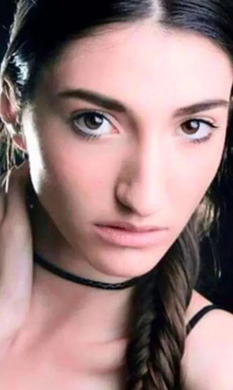 Türkiyə gözəlinin estetik xərcləri üzə çıxdı