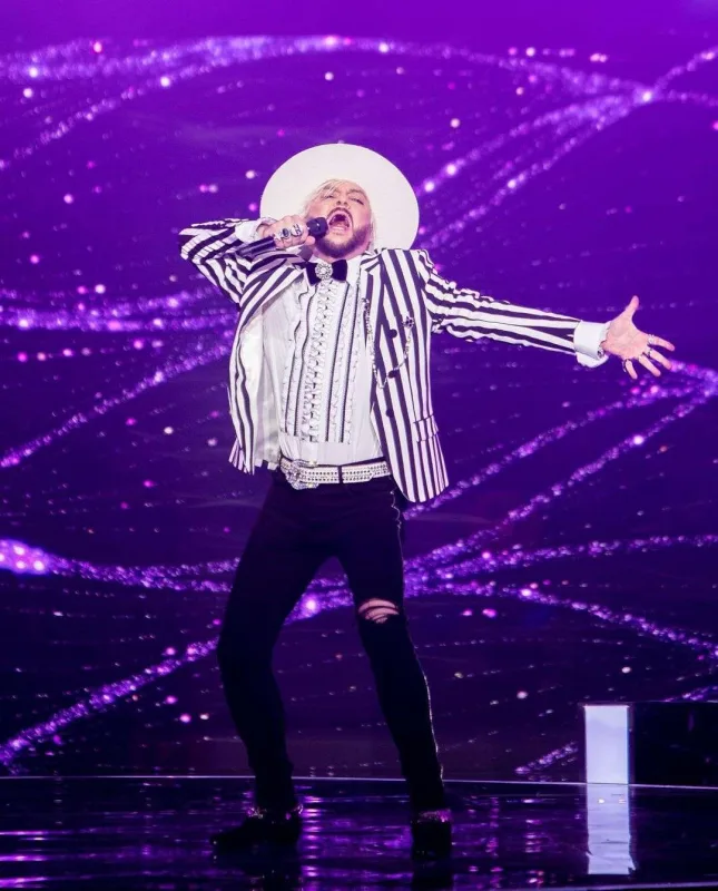 Kirkorov plastik əməliyyat etdirdi