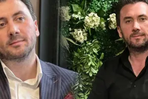 Üzündə botoks olduğunu açıqladı