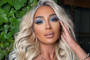 Çinarə yenidən estetik etdirdi