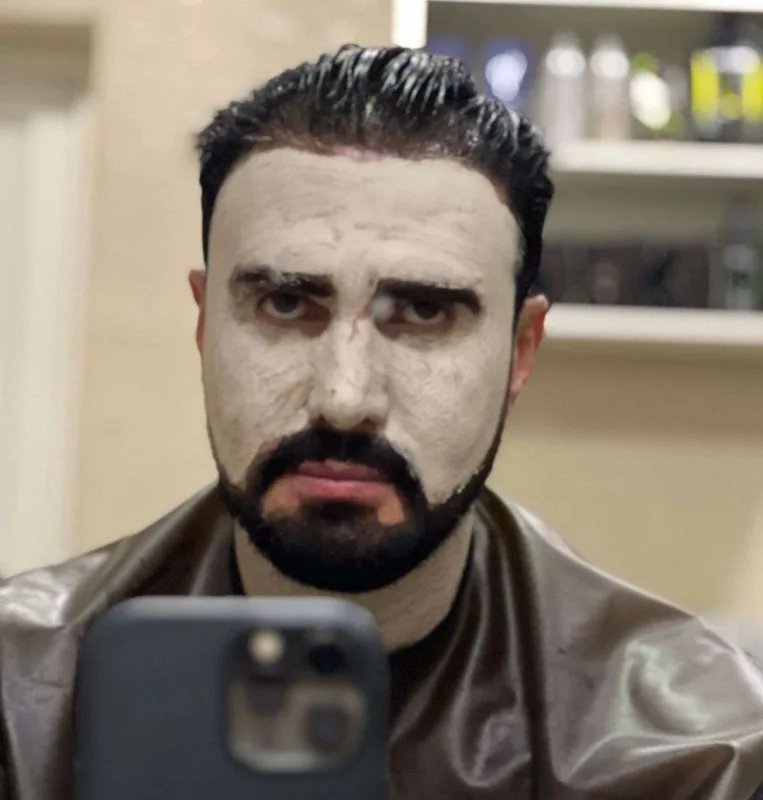 Nadir paylaşımı ilə təəccübləndirdi