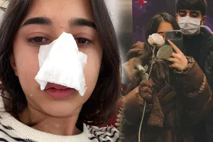 Sevgilisi tərəfindən döyülən Atlas əməliyyat olunacaq