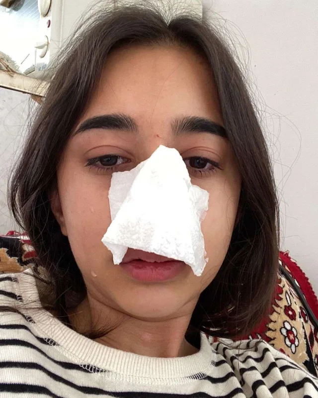 Sevgilisi tərəfindən döyülən Atlas əməliyyat olunacaq