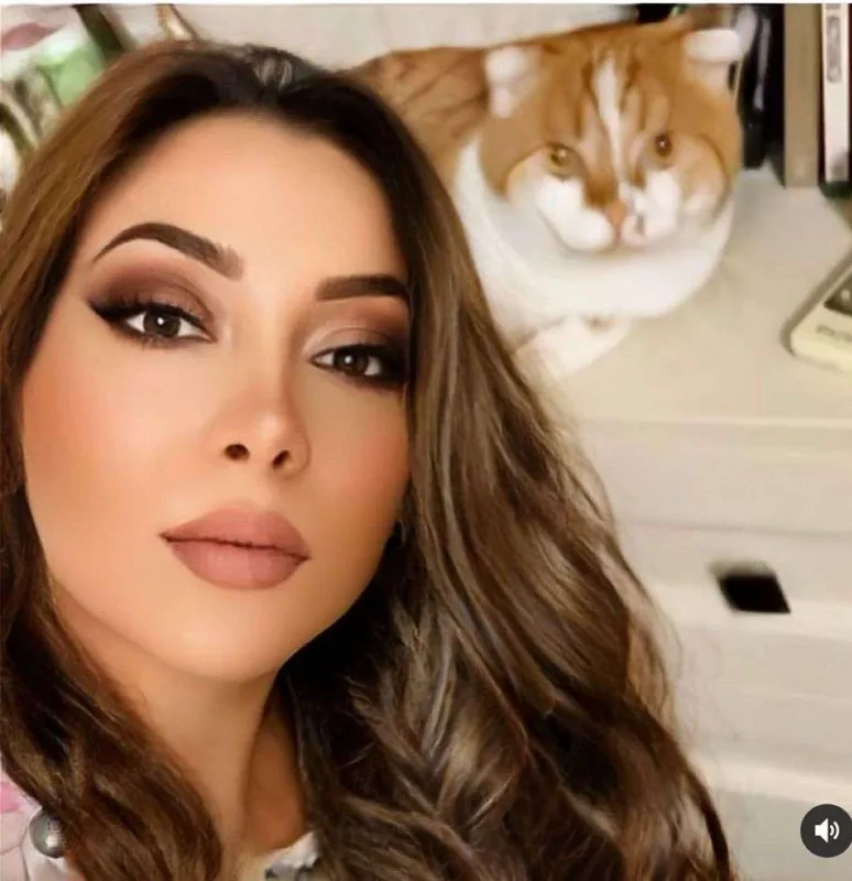 Bellaya bənzəmək üçün estetik etdirdi