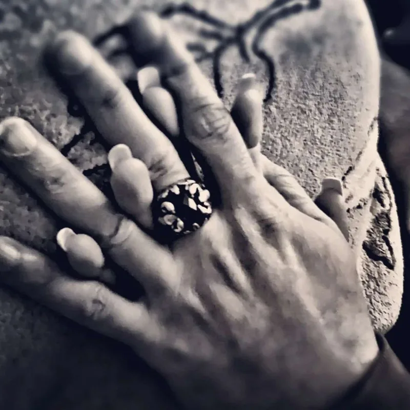 Aqil stomotoloqla eşq yaşayır