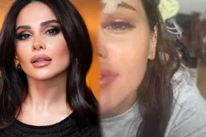 Günelin qaşına 7 tikiş qoyuldu