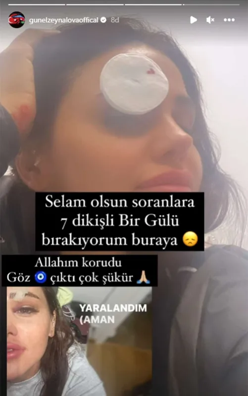 Günelin qaşına 7 tikiş qoyuldu