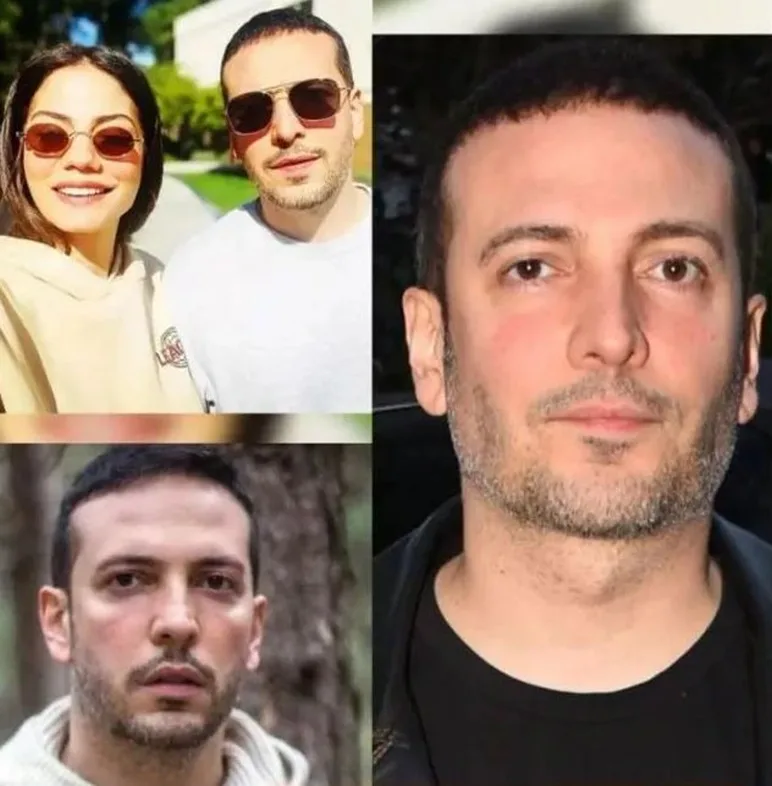 Sərt çənəyə sahib olmaq üçün bunu etdi