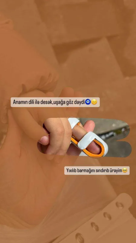Yıxılıb barmağını sındırdı