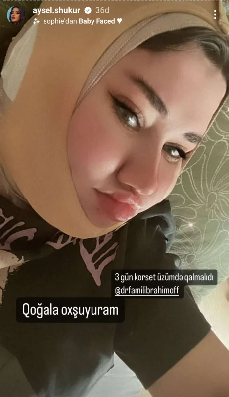 Aysel növbəti dəfə əməliyyat olundu
