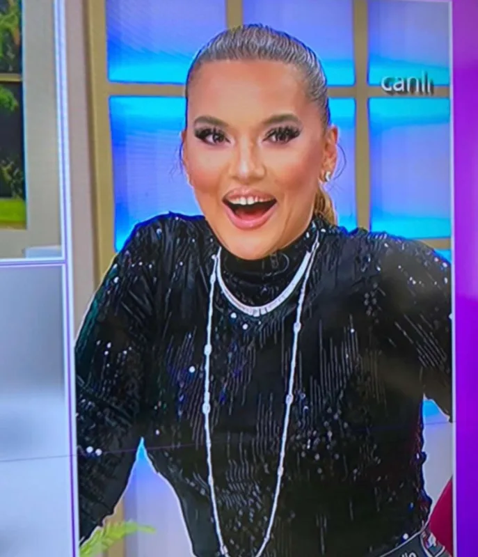 “Demetə filter kimi makiyaj edib”