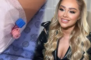 “15 dişini 1 gündə müalicə etdirən necə olar?”