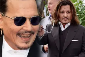 Baxımsız dişləri diqqət çəkdi