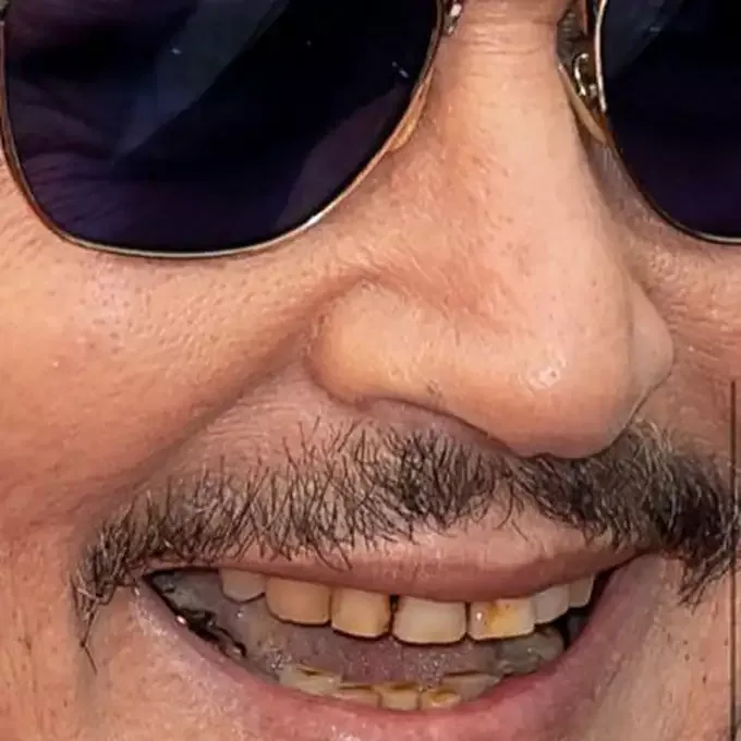 Baxımsız dişləri diqqət çəkdi