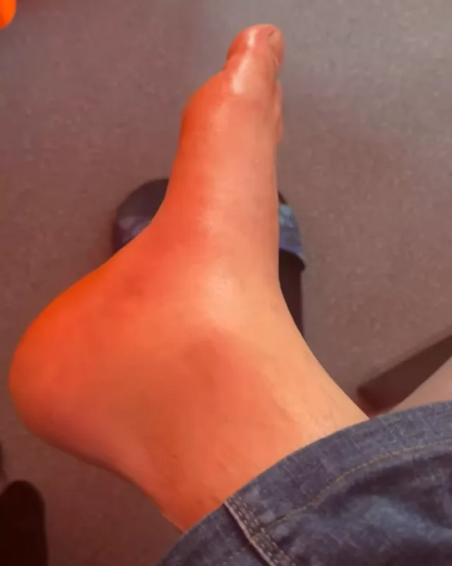 Tolikin səhhətində problem yarandı