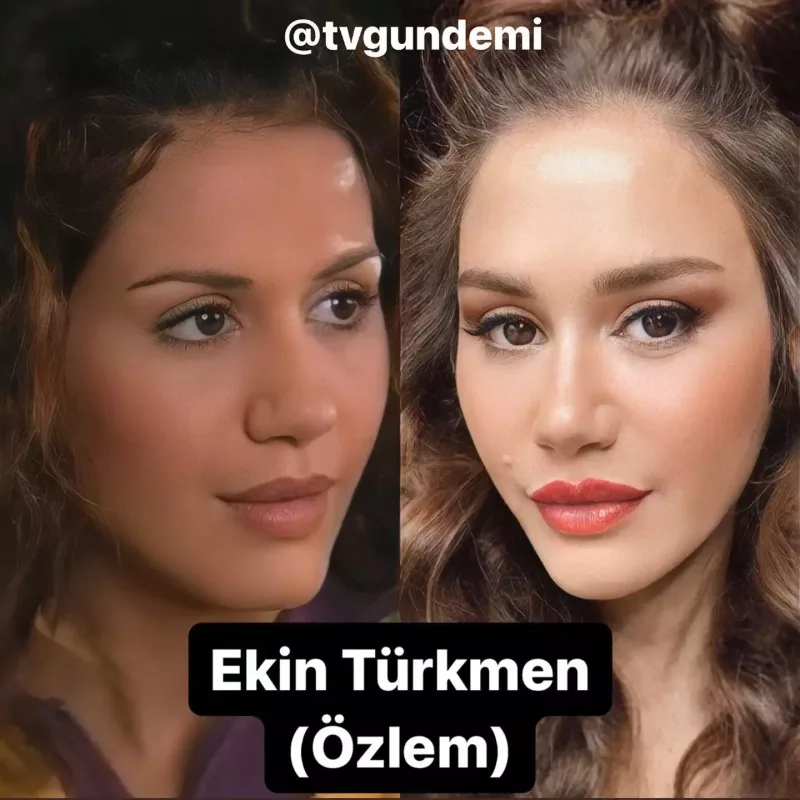 “Acı Hayat”ın aktyorları 18 il sonra...