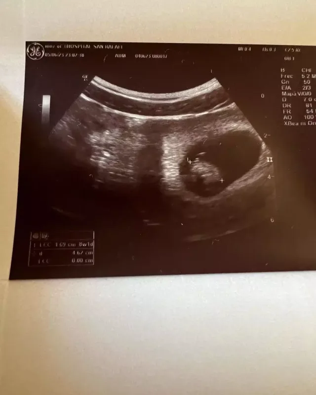 “Elite”in ulduzu ata olacaq