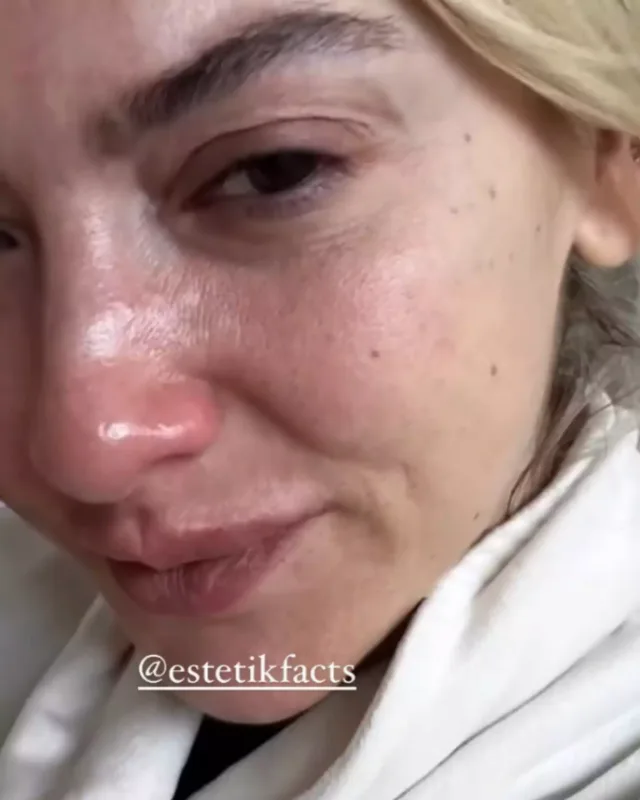 Makiyajsız və gözü yaşlı... - Foto