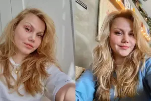 Məşhur "Youtuber" ölümcül halda! Əri 32 yerindən...