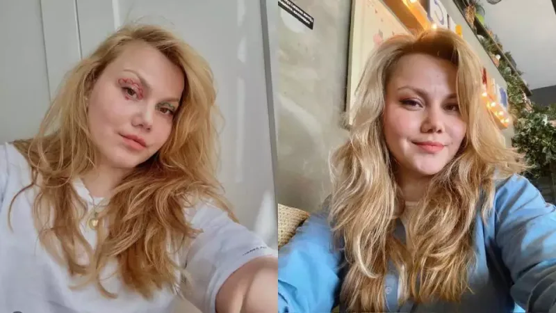 Məşhur "Youtuber" ölümcül halda! Əri 32 yerindən...