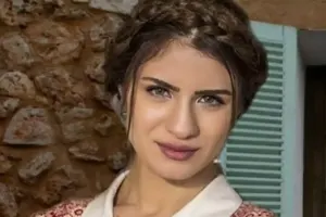 Plastik əməliyyatla özünü dəyişdi