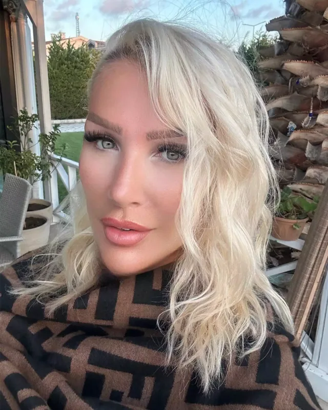 Üzünə sünnət dərisi vurdurdu