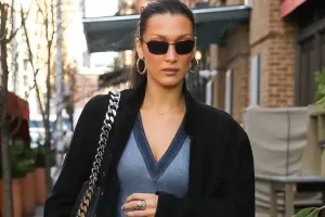 Bella Hadid artıq sağalıb