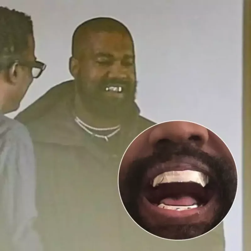 Ağzında 850 min dollar daşıyır