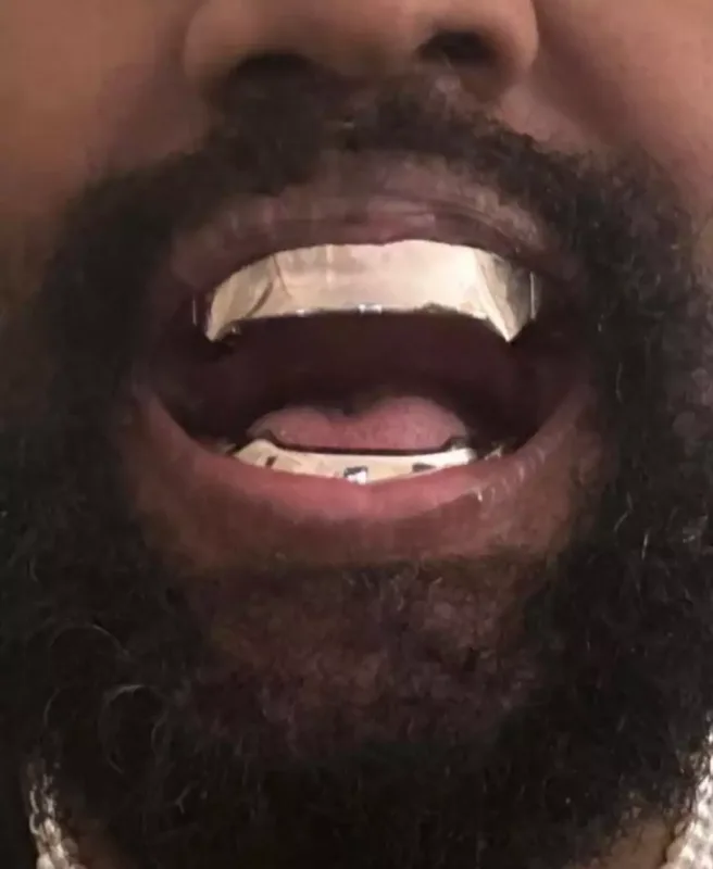 Ağzında 850 min dollar daşıyır