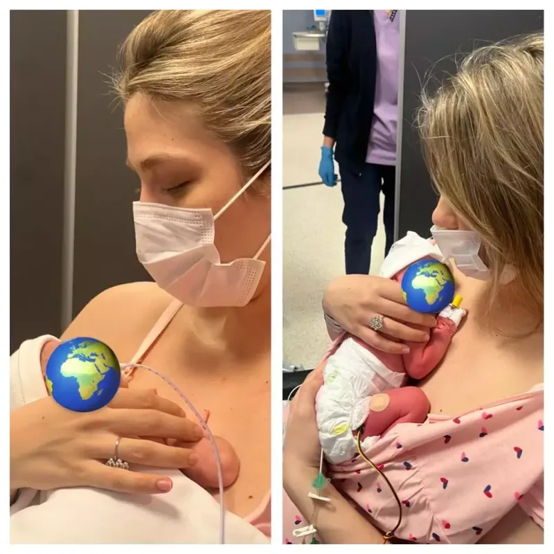 Əkizlərdən birinin səhhətində problem yarandı