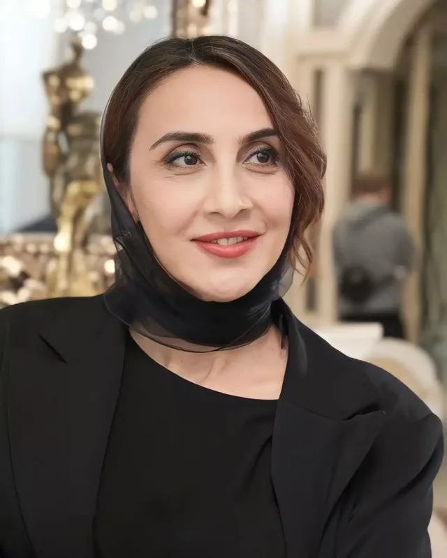 “Xanımların əksəriyyəti arı vurmuş kimi görünür”