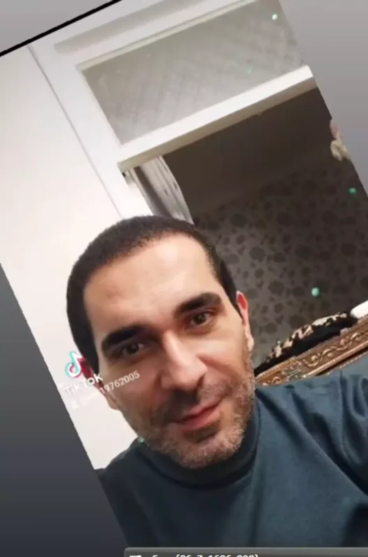 Estetiklə belə dəyişdi