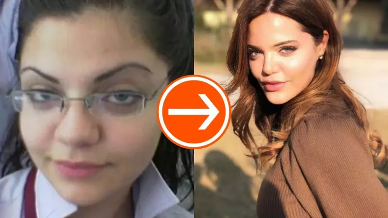 “Sadəcə 2 yerimdə estetik var”