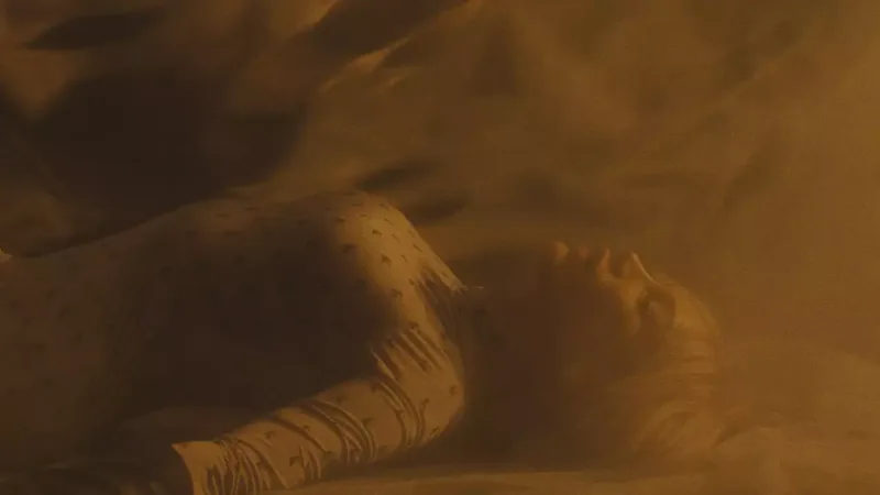 Röya Ayxan estetik əməliyyat etdirib