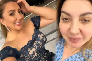 Nazilə əməliyyat olundu