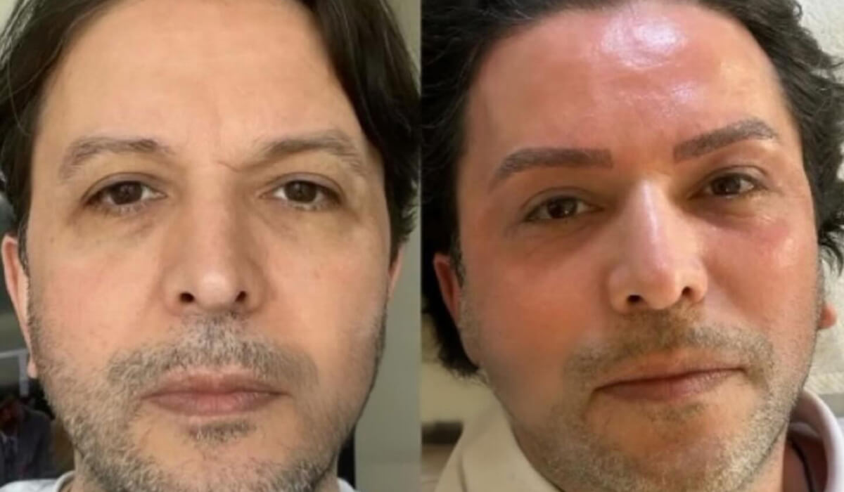 Nihat Doğan estetik etdirdi